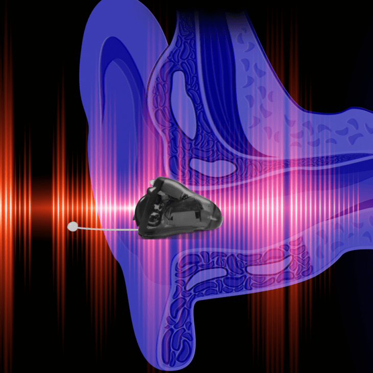 How Hearing Aids Work Salus Hearing and Tinnitus Centre