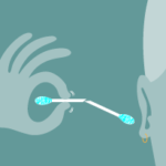 should-i-clean-my-ears-at-home