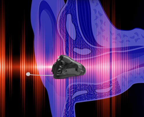 How Hearing Aids Work